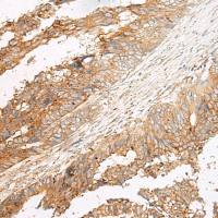 兔抗GPR17多克隆抗体