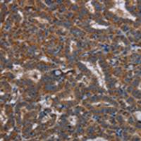 兔抗LYN多克隆抗体