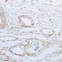 兔抗SLC5A5多克隆抗体