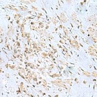 兔抗PGR多克隆抗体