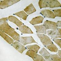 兔抗MYH4多克隆抗体