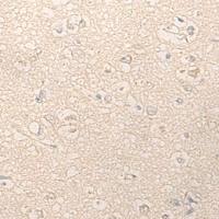 兔抗GASK1A多克隆抗体