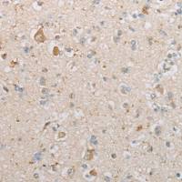 兔抗PRKACA多克隆抗体