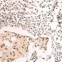 兔抗NOP58多克隆抗体