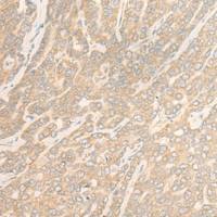 兔抗WDR6多克隆抗体