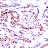 兔抗ATF2 (Phospho-Ser112 or 94)多克隆抗体