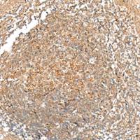 兔抗GRHPR多克隆抗体