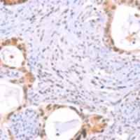 兔抗PROS1多克隆抗体