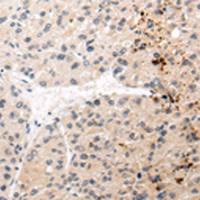 兔抗AQP11多克隆抗体