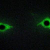 兔抗PIKFYVE多克隆抗体