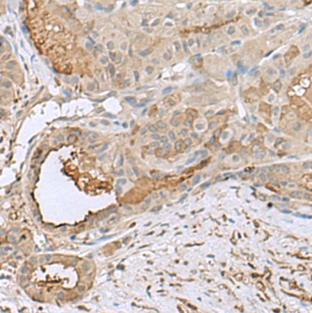 兔抗GABARAPL2多克隆抗体