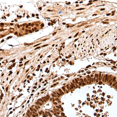 兔抗GAR1多克隆抗体