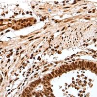 兔抗GAR1多克隆抗体