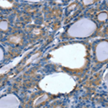 兔抗SLITRK4多克隆抗体