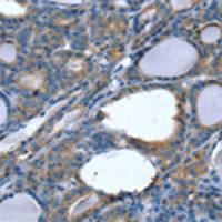 兔抗SLITRK4多克隆抗体