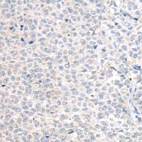 兔抗MT-ND5多克隆抗体