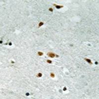 兔抗FER(Phospho-Tyr402) 多克隆抗体