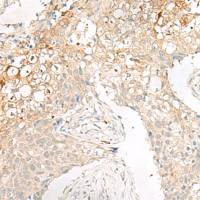 兔抗GPR78多克隆抗体