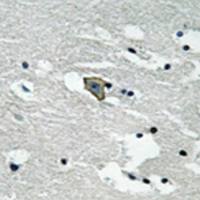 兔抗FLT1(Phospho-Tyr1048) 多克隆抗体