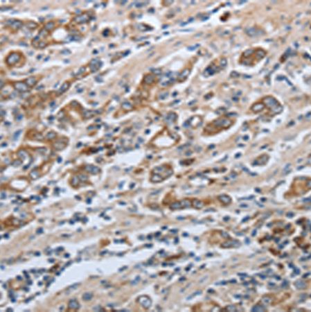 兔抗SLC34A2多克隆抗体