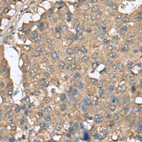 兔抗EIF4A2多克隆抗体