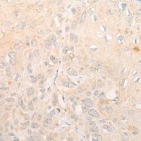 兔抗CORO7多克隆抗体