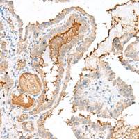 兔抗GARNL3多克隆抗体