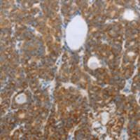 兔抗RNF126多克隆抗体