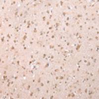 兔抗YY1AP1多克隆抗体