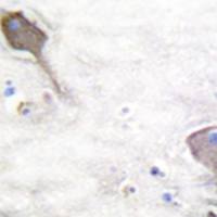 兔抗PARK2多克隆抗体