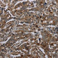 兔抗GLUL多克隆抗体