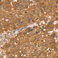 兔抗RNASET2多克隆抗体