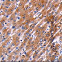 兔抗PPP1R13B多克隆抗体