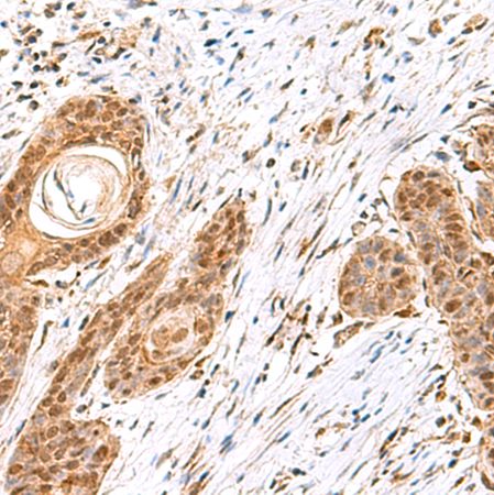 兔抗MECR多克隆抗体