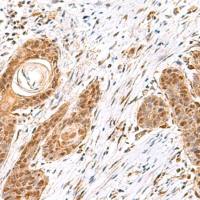 兔抗MECR多克隆抗体