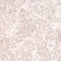 兔抗EMX2多克隆抗体