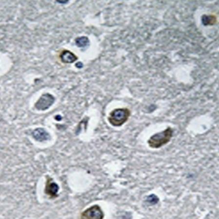 兔抗MARCH4多克隆抗体