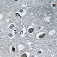 兔抗MARCH4多克隆抗体