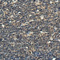 兔抗WDFY2多克隆抗体