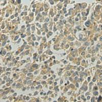 兔抗VPS39多克隆抗体