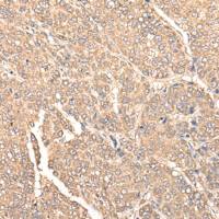 兔抗WDFY1多克隆抗体