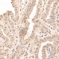 兔抗SAP130多克隆抗体