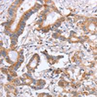 兔抗ITGB5多克隆抗体