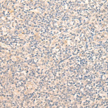 兔抗GCNT3多克隆抗体