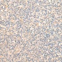 兔抗GCNT3多克隆抗体