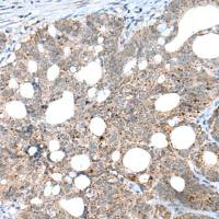 兔抗CLEC4M多克隆抗体