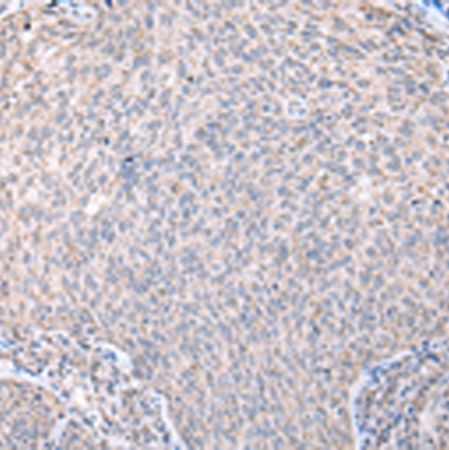 兔抗DYNLL2多克隆抗体