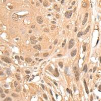 兔抗MED23多克隆抗体