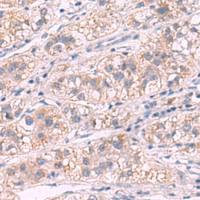 兔抗G6PC多克隆抗体