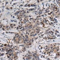 兔抗GABARAP多克隆抗体